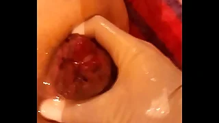 Fist Charge from Serbia